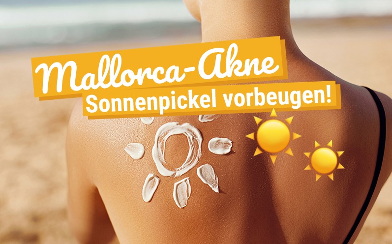 Mallorca-Akne: Wie Du Sonnenpickel vorbeugen kannst!