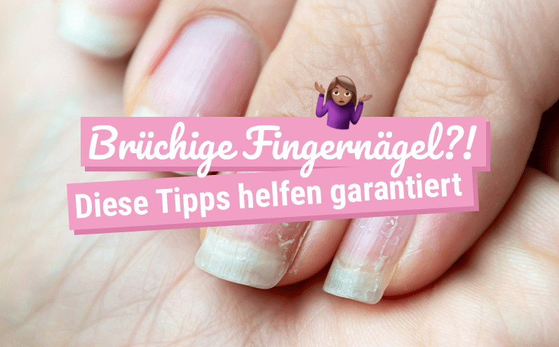 Brüchige Fingernägel – Mit diesen Tipps wirst Du sie garantiert wieder los!